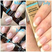Apothaka SOS recovery nail and cuticle oil nail customer progress