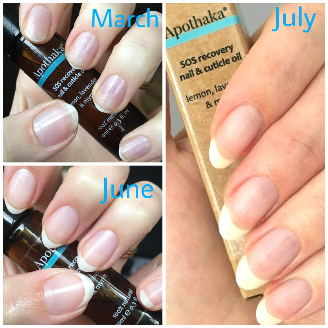 Apothaka SOS recovery nail and cuticle oil nail customer progress